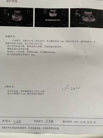 journal_insert_pic_1675022974