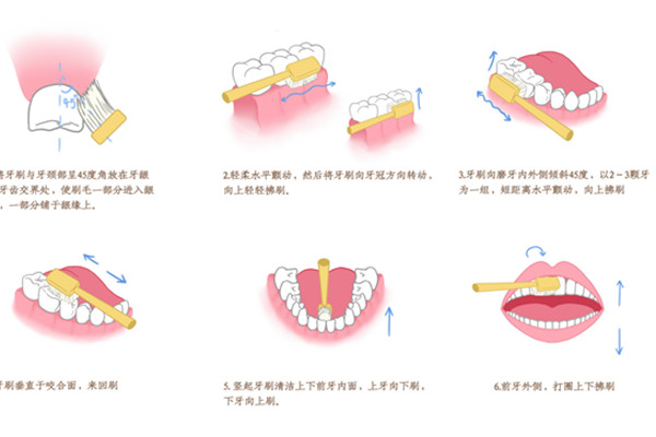 刷牙出血6001.jpg